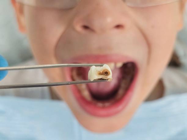 Best Emergency Gum Treatment in Bayou Vista, LA